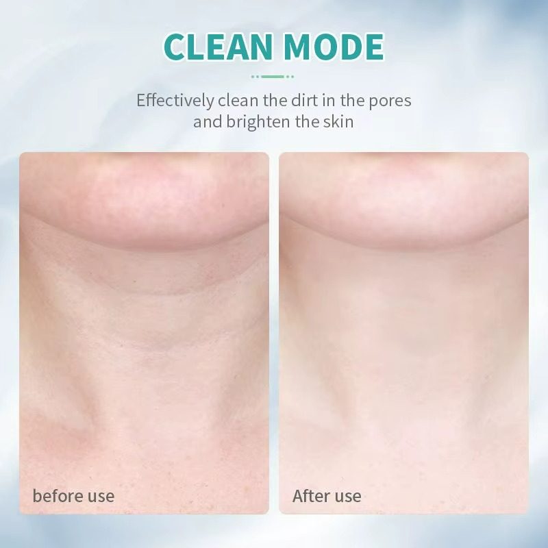 IPL Wrinkles Reducing Instrument